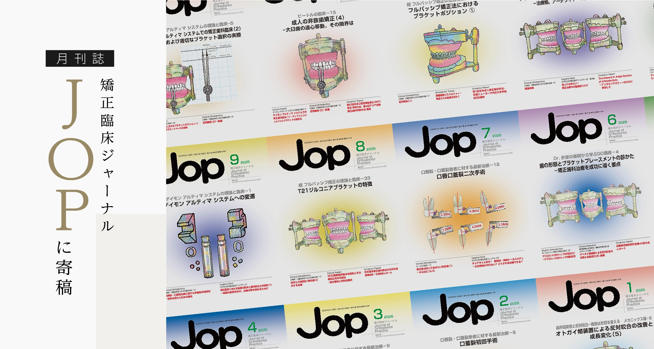 JOP（矯正臨床ジャーナル）に寄稿｜さわだ矯正歯科クリニック