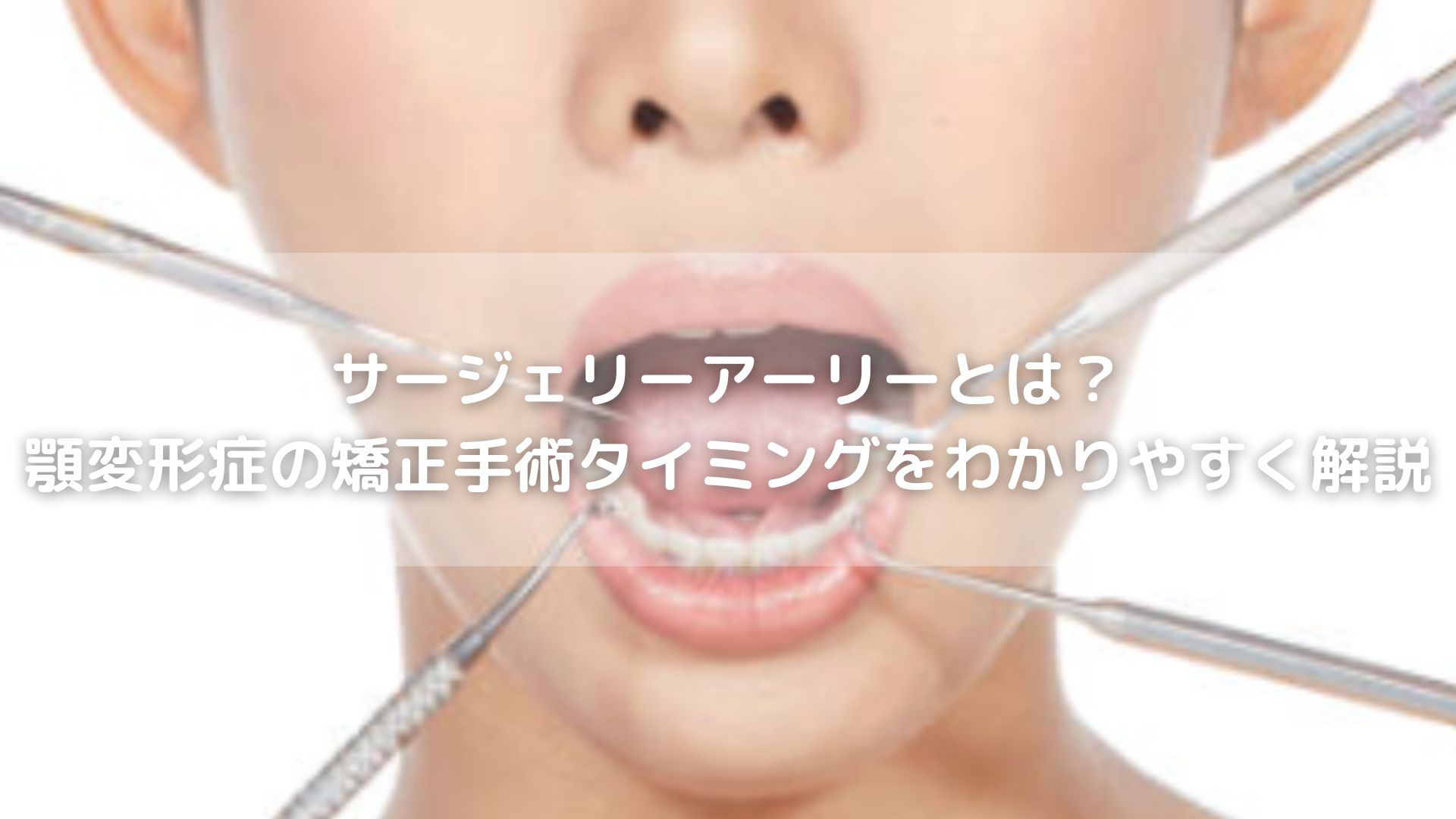 サージェリーアーリーとは？顎変形症の矯正手術タイミングをわかり