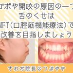 口ゴボや開咬の原因の一つ？舌のくせはMFT（口腔筋機能療法）で改善を目指しましょう