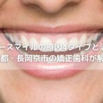 ガミースマイルの原因4タイプと治療法｜京都・長岡京市の矯正歯科が解説